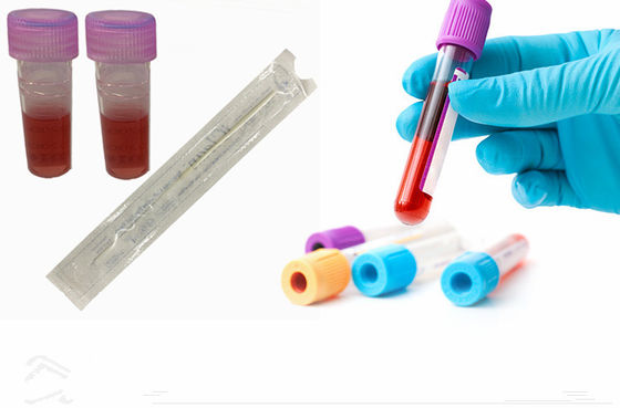 Tüplü Naylon Elyaf Steril Taşıma Çubuğunu Örneklemek İçin Akınlı DNA Bukkal Swablar